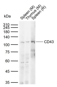 CD43 antibody