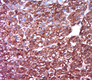 SLC22A11 Rabbit Polyclonal Antibody
