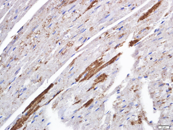 TSPAN6 Rabbit Polyclonal Antibody