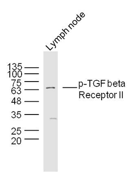 Phospho-TGF beta Receptor II (Ser225) Rabbit Polyclonal Antibody