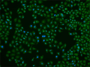 ZNF710 Rabbit Polyclonal Antibody