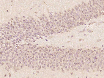 ZNF775 Rabbit Polyclonal Antibody