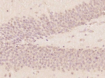 ZNF775 antibody
