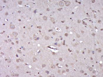 Phospho-ZIP Kinase (Thr265) Rabbit Polyclonal Antibody