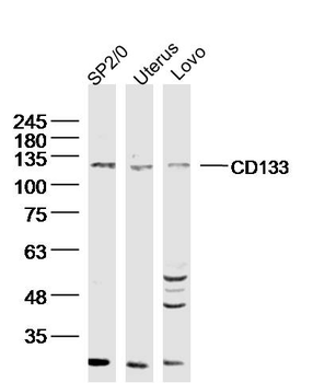 CD133 Rabbit Polyclonal Antibody
