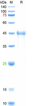 Recombinant human AD7c-NTP protein, His