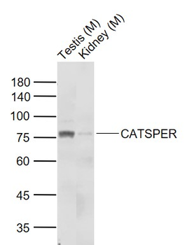 CATSPER Rabbit Polyclonal Antibody