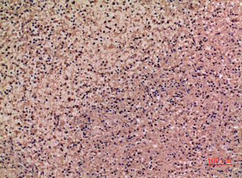 IL-28 Rabbit Polyclonal Antibody