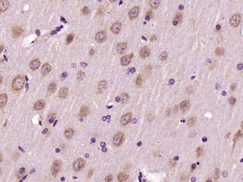 Dynamin 2 Rabbit Polyclonal Antibody