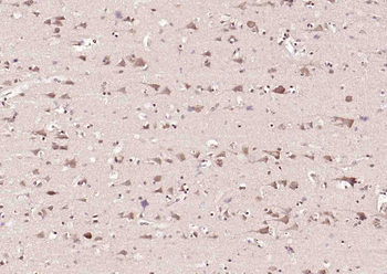 Phospho-c-Abl (Tyr226) Rabbit Polyclonal Antibody