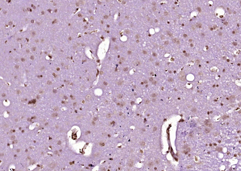 Phospho-c-Abl (Tyr276) Rabbit Polyclonal Antibody