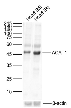 ACAT1 Rabbit Polyclonal Antibody