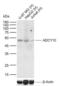 ADCY10 Rabbit Polyclonal Antibody