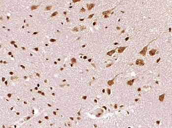 CBS Rabbit Polyclonal Antibody