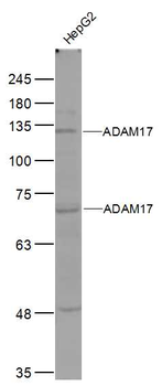 ADAM17 Rabbit Polyclonal Antibody