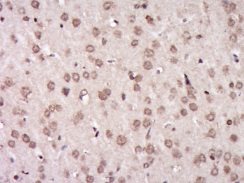 AGPAT1 Rabbit Polyclonal Antibody