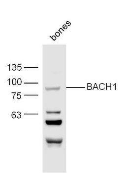 BACH1 Rabbit Polyclonal Antibody