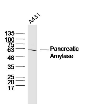 Pancreatic Amylase Rabbit Polyclonal Antibody