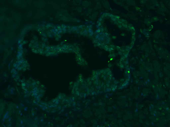 PLCZ1 Rabbit Polyclonal Antibody