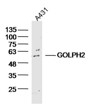 GOLPH2 Rabbit Polyclonal Antibody