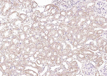 Phospho-PRKD1 (Ser738) Rabbit Polyclonal Antibody