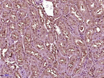 TNIK Rabbit Polyclonal Antibody