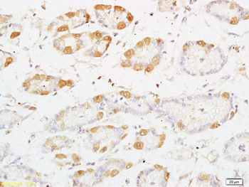 PRKD3 Rabbit Polyclonal Antibody