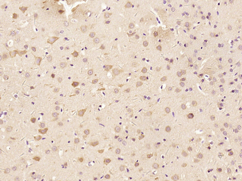 ABAT Rabbit Polyclonal Antibody
