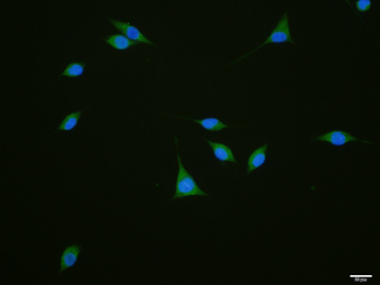 GEF H1 Rabbit Polyclonal Antibody