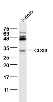 COX3 Rabbit Polyclonal Antibody