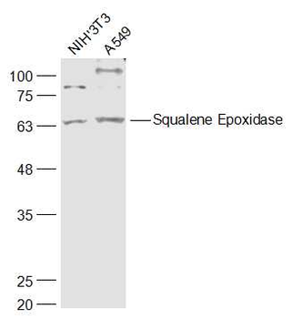Squalene Epoxidase Rabbit Polyclonal Antibody