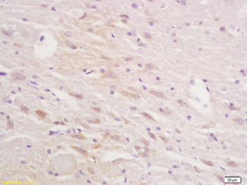 Squalene Epoxidase Rabbit Polyclonal Antibody
