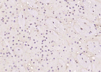 TBLR1 Rabbit Polyclonal Antibody
