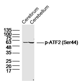 Phospho-ATF2 (Ser62 / Ser44) Rabbit Polyclonal Antibody