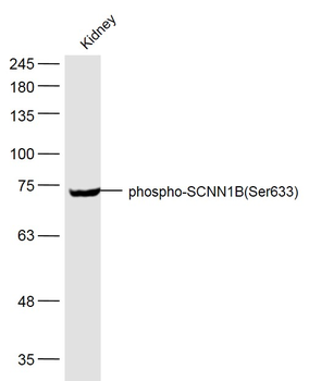 Phospho-SCNN1B (Ser633) Rabbit Polyclonal Antibody
