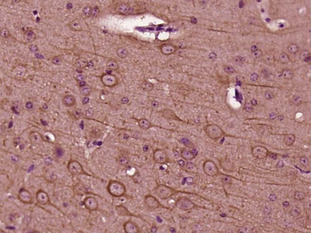 Phospho-BCL10 (Ser218) Rabbit Polyclonal Antibody