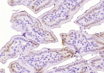 Phospho-Bcl-xL (Thr115) Rabbit Polyclonal Antibody