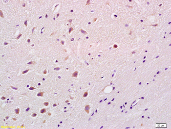 Phospho-Bim (Ser87) Rabbit Polyclonal Antibody