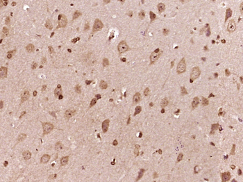 ProBNP Rabbit Polyclonal Antibody