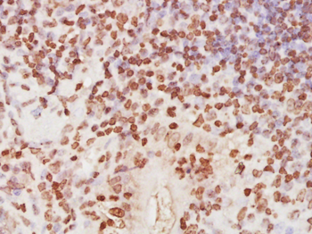 RPA2 Rabbit Polyclonal Antibody