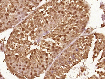 Phospho-BRAF (Ser446) Rabbit Polyclonal Antibody