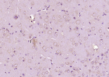 Phospho-BRAF (Thr597) Rabbit Polyclonal Antibody