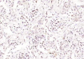 RAD9 Rabbit Polyclonal Antibody