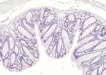 RAD9 Rabbit Polyclonal Antibody