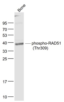 RAD51 (phospho-Thr310) antibody