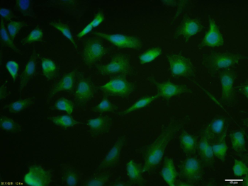 MUC1 Rabbit Polyclonal Antibody