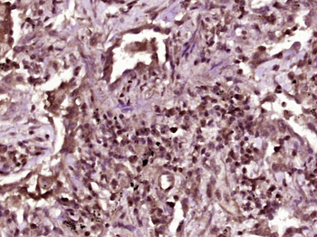 Phospho-Beta catenin (Tyr86) Rabbit Polyclonal Antibody
