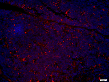 CCL25 Rabbit Polyclonal Antibody
