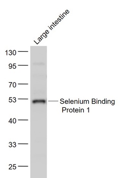 Selenium Binding Protein 1 antibody