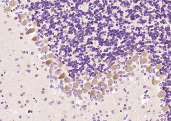 Bcr Rabbit Polyclonal Antibody
